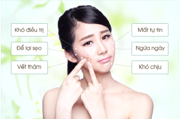 Mụn trứng cá ở tuổi dậy thì có thể tự khỏi nhưng phần trăm khá thấp.