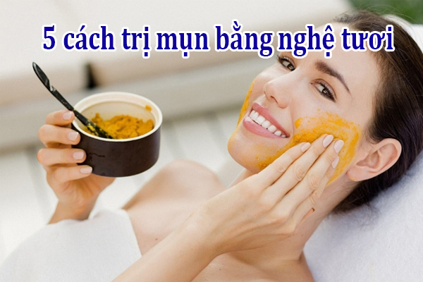 Trị mụn bằng nghệ tươi như thế nào
