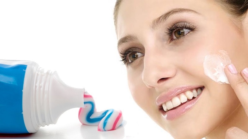 Trị mụn bằng kem đánh răng chỉ phù hợp với những tình trạng bệnh nhẹ.