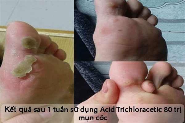 4 4