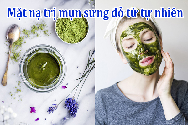 Top 17 mặt nạ trị mụn sưng đỏ với nguyên liệu thiên nhiên an toàn 1 Cach lam Mat na tri mun sung do tu tu nhien