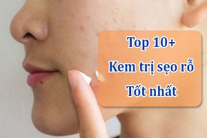 Chon dung kem tri seo de su dung cang som se cang giup cai thien tinh trang seo ro hon