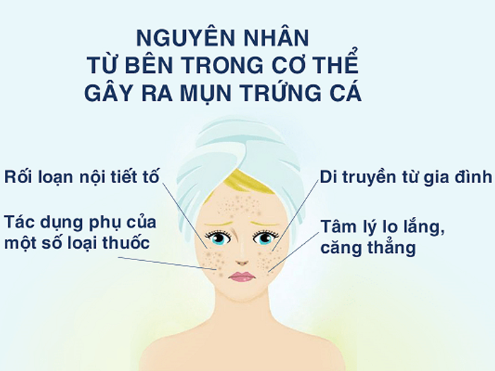 Nguyen nhan gay ra mun trung ca ngua va cac trieu chung kem theo