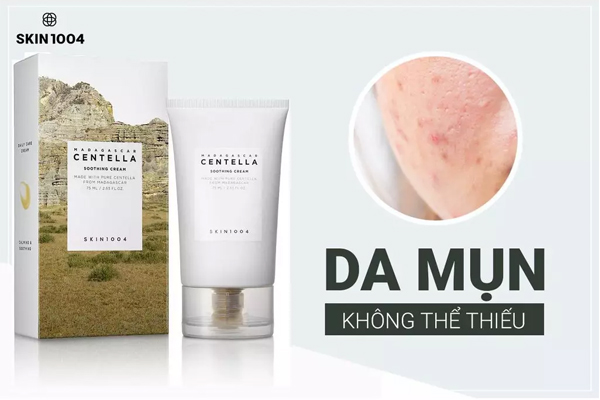 Kem trị mụn ẩn Madagascar Centella Asiatica Cream