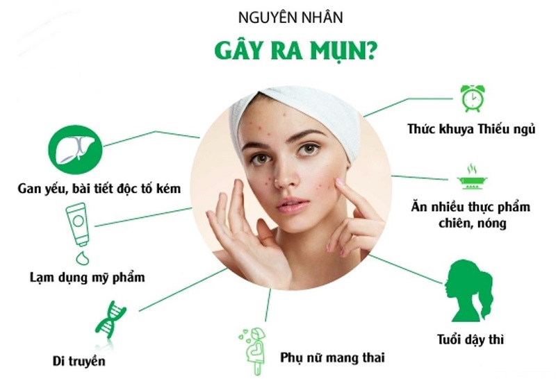 Mụn trứng cá quanh miệng: Nguyên nhân và cách khắc phục hiệu quả 2 mun trung ca quanh mieng 2