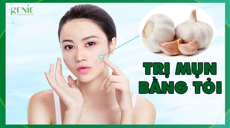 5 Cách trị mụn thâm bằng tỏi an toàn, hiệu quả 3 Đắp tỏi lên vùng da bị mụn giúp cải thiện tình trạng mụn hiệu quả.