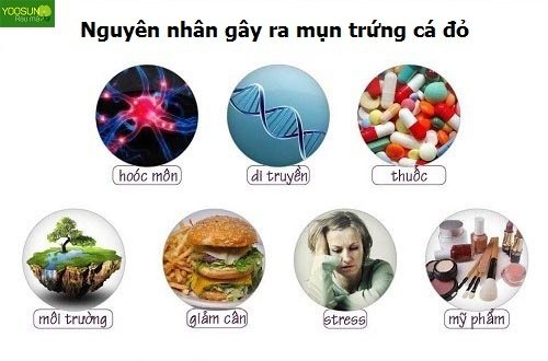 Nguyên nhân gây mụn trứng cá đỏ là gì?
