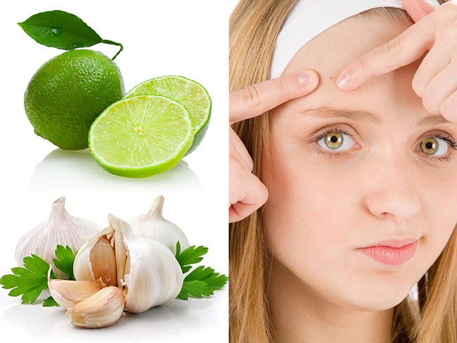 Mụn thâm tụ máu: nguyên nhân và cách điều trị tại nhà 5 cach tri mun nhanh chong tai nha don gian hieu qua bat ngo anh 1
