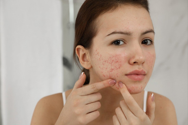 Trong quá trình điều trị cần xây dựng chế độ ăn uống và sinh hoạt lành mạnh.