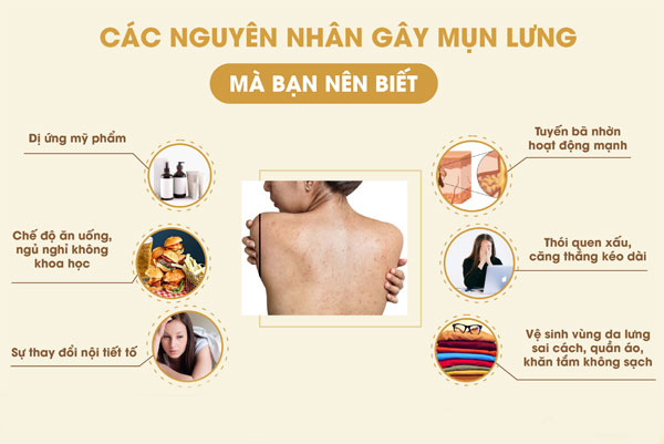 Cách trị mụn thâm lưng bằng 11 công thức đơn giản tại nhà 1 mun lung