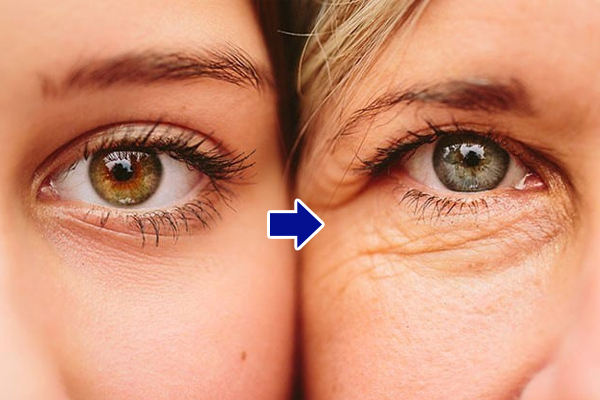Chính vì da bọng mắt mỏng nên rất dễ bị lão hóa, thâm đen, vì vậy mà cần dưỡng mắt thường xuyên ngay từ khi còn trẻ