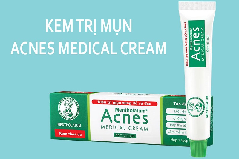 Acnes Medical Cream la kem tri mun o nha thuoc tay co gia ban hop tui tien hoc sinh sinh vien