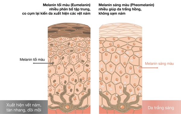 Sự sản sinh bất thường Melanin có liên quan đến tuổi tác và nội tiết tại những vùng da tiếp xúc nhiều với tia UV gây ra các vết nám