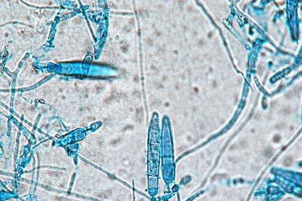 Bệnh nấm da đầu có lây không? 2 Hình ảnh hiển vi của vi nấm Microsporum gây bệnh nấm da đầu.