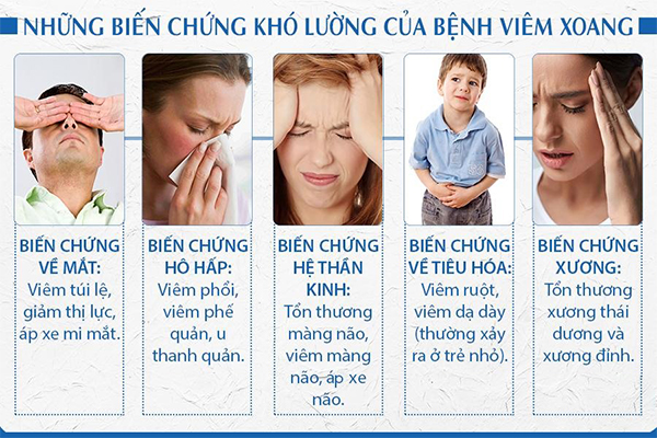 Các biến chứng của viêm xoang hàm Các biến chứng của viêm xoang hàm