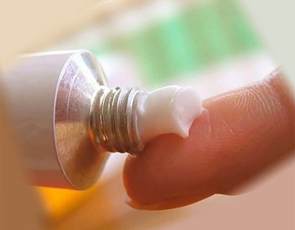 Dùng kem bôi trị ngứa và loại bỏ mảng bám trên da đầu