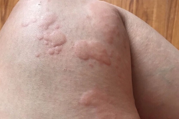ngua da 3