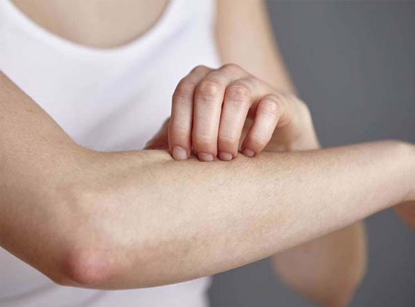 Nếu ngứa kéo dài hơn 2 tuần, bạn nên đi khám