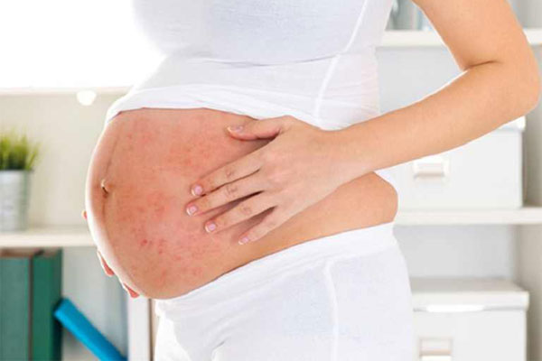 Phụ nữ có thai cần thận trọng khi dùng thuốc