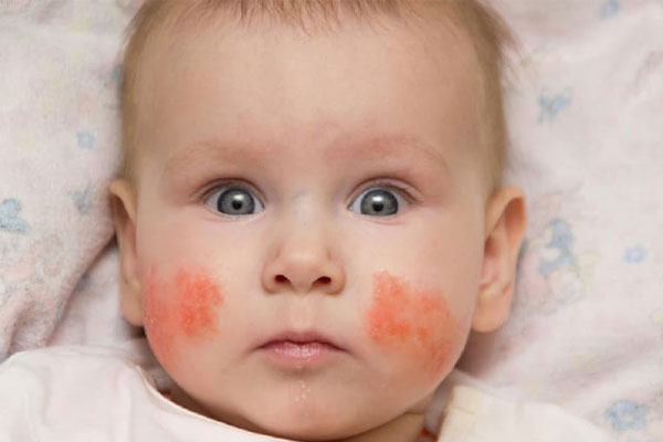 Tuyệt đối không dùng thuốc cho trẻ em dưới 2 tuổi