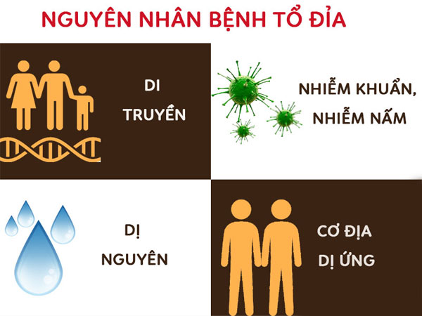 Tổ Đỉa Là Gì? Nguyên Nhân, Triệu Chứng Và Cách Điều Trị 2023 3 to dia 3