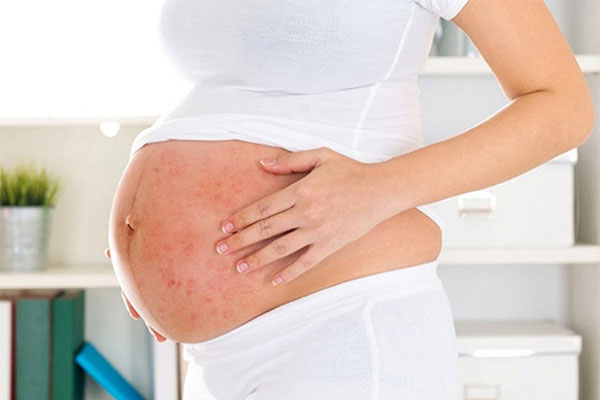Viêm Da Dầu: Nguyên Nhân, Triệu Chứng Và Cách Điều Trị 5 Bệnh viêm da tiết bã không lây nhưng lây sang trẻ em