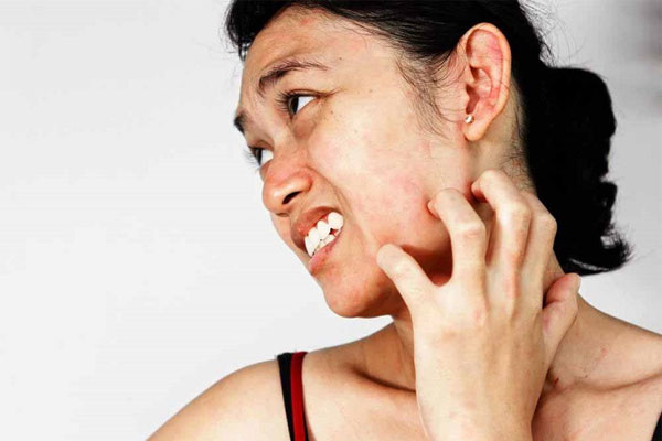 Viêm da dị ứng ở mặt là bệnh gây ra các tổn thương trên da và bắt đầu xuất hiện ở mặt.