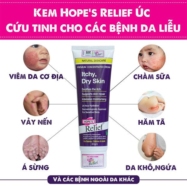 Thuốc Bôi Tổ Đỉa: 9 Loại Thuốc Tốt Nhất Hiện Nay 2023 5 Thuoc Boi To Dia 5