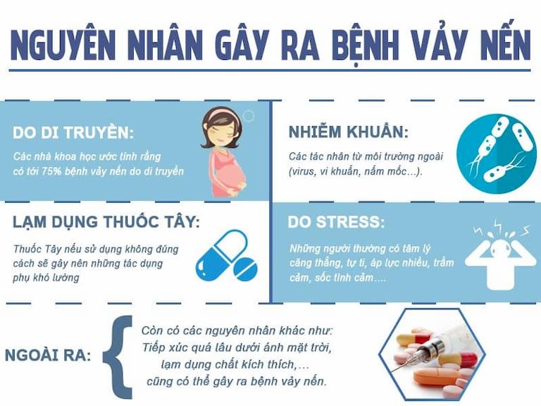 Vảy Nến Da Mặt: Nguyên Nhân, Triệu Chứng, Điều Trị 2023 2 Nguyên nhân của bệnh vẩy nến trên da mặt