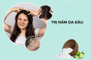 Mua thuốc trị nấm da đầu tại Thái Bình 7