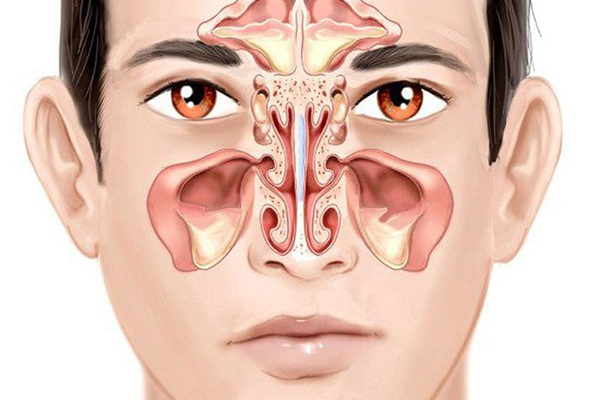 Những lưu ý khi dùng thuốc trị viêm xoang