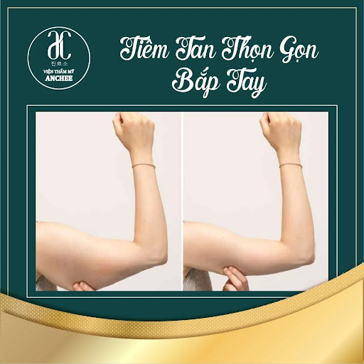 Lý giải cơn sốt của dịch vụ tiêm botox bắp tay giảm béo 1 tiem botox bap tay giam beo 2
