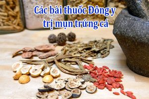 Các bài thuốc Đông y trị mụn trứng cá