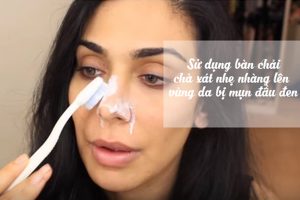 Cách trị mụn đầu đen bằng kem đánh răng