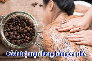 Cách trị mụn lưng bằng cà phê