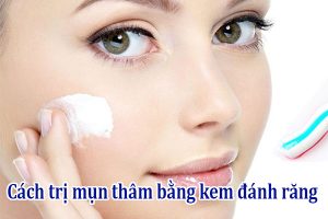 Cách trị mụn thâm bằng kem đánh răng