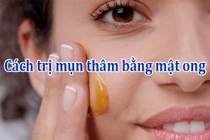 Cách trị mụn thâm bằng mật ong