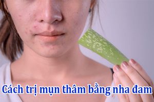 Cách trị mụn thâm bằng nha đam