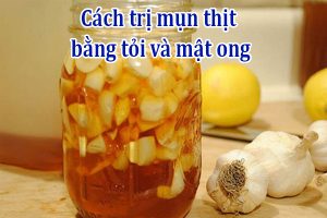 Cách trị mụn thịt bằng tỏi và mật ong