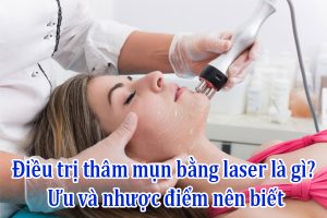 Điều trị thâm mụn bằng laser có những ưu nhược điểm gì
