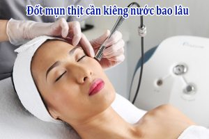 Đốt mụn thịt cần kiêng nước bao lâu
