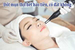 Đốt mụn thịt có đắt không