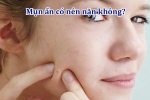 Mụn ẩn có nên nặn không