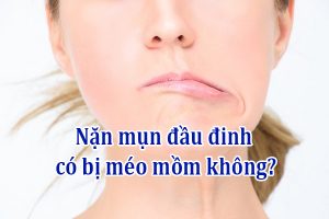 Nặn mụn đầu đinh có bị méo mồm không
