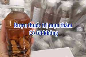 Rượu thuốc trị mụn thâm có tốt không