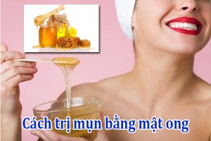 cách trị mụn bằng mật ong