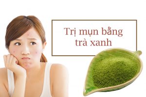 Trị mụn ẩn bằng trà xanh là một trong những phương pháp điều trị hiệu quả.