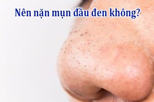 Nên nặn mụn đầu đen không?