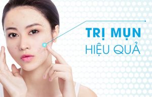 Có nên sử dụng serum trị mụn thâm cho da dầu không