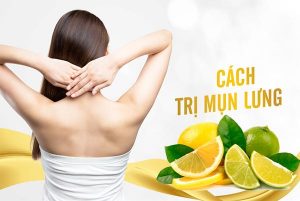 Trị mụn ở lưng băng chanh tươi được nhiều chị em tin tưởng.
